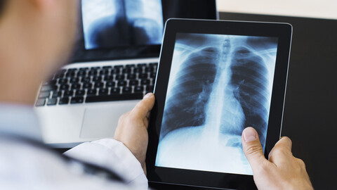Doctor reviewing chest x-ray on tablet